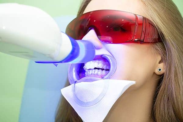 Laser teeth whitening treatments Nottingham