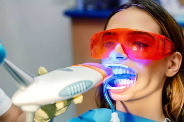 Simplifying Teeth Whitening: A Comprehensive Guide Nottingham