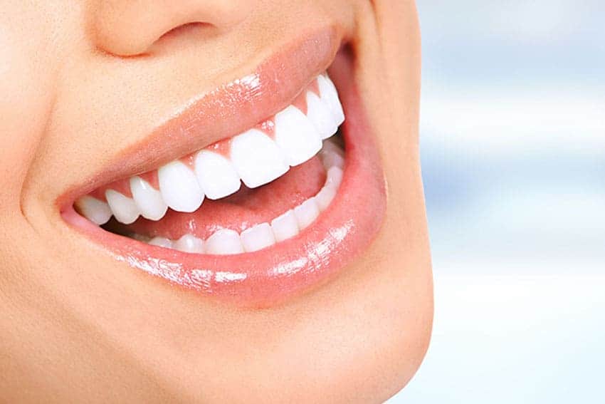 Teeth Whitening Abingdon Nottingham