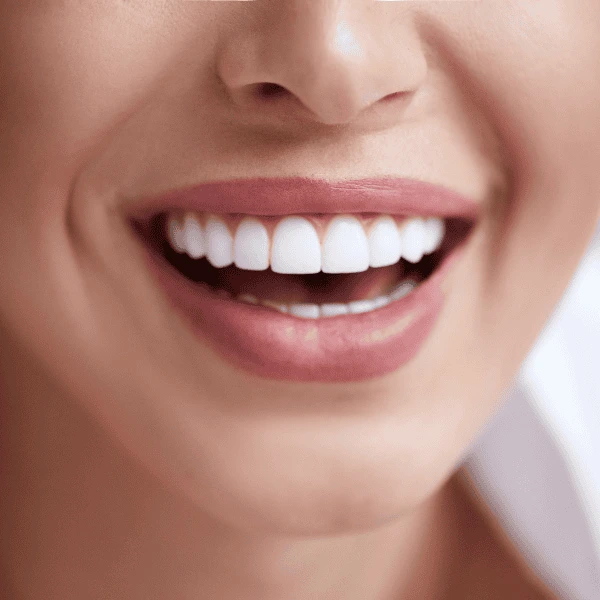 Get A whiter smile fast! Book with LA Teeth Whitening today! Nottingham