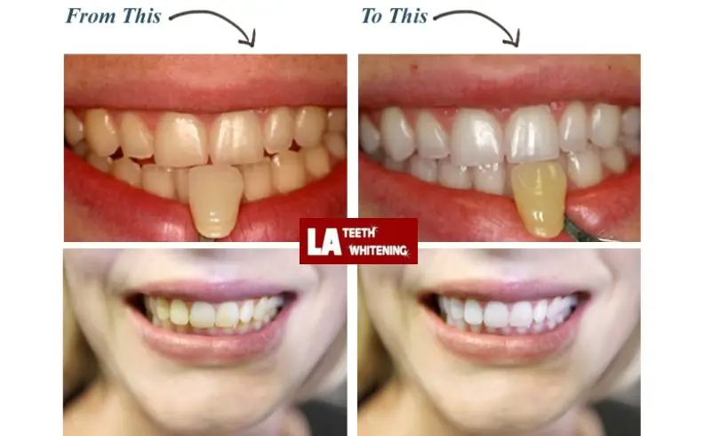 I Don't Want My Teeth Too White Nottingham