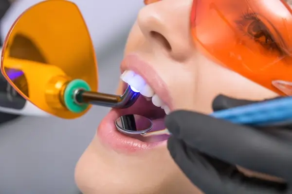 Relaxed woman receiving safe Laser Teeth Whitening for discoloured teeth Nottingham